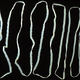 Illustration for article titled How to Kill a Parasitic Worm Living Inside of You